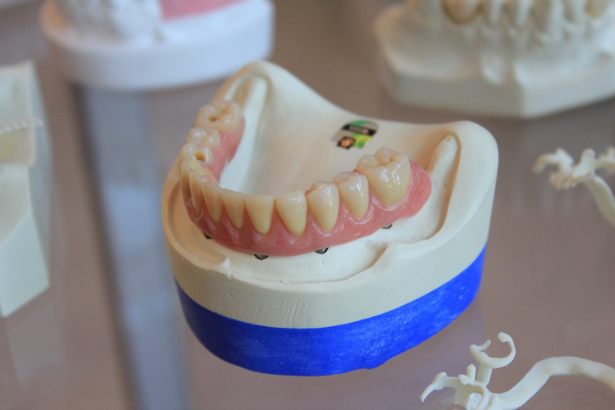 Types Of Dental Prosthetics And Their Installation Stages Dentistry Articles 6340